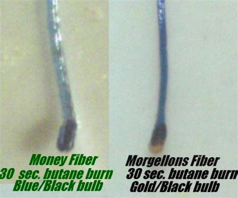 Comparative Study of Morgellons Fibers With The Colored Fibers Found of U.S. Currency