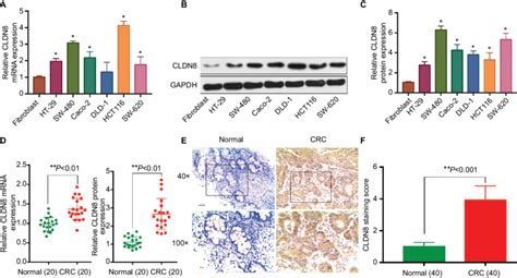 Cldn8 Is Overexpressed In Crc Cell Lines And Clinical Human Crc