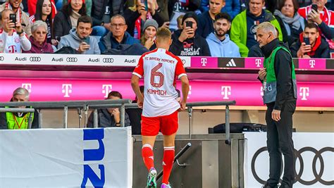 FC Bayern Kimmichs Blitz Blackout und Folgen Abendzeitung München