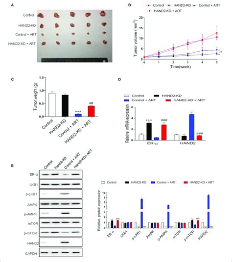 Artesunate Art Inhibited Tumor Proliferation Via The Hand