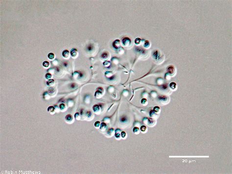 Cyanobacteria/Synechococcales/Coleosphaeriaceae/Snowella/litoralis/103.jpg