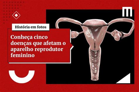 Conheça cinco doenças que afetam o aparelho reprodutor feminino