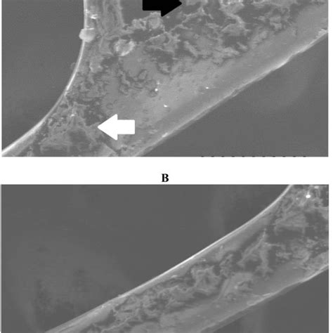 Scanning Electron Photomicrographs Of The Posterior Surface Of The