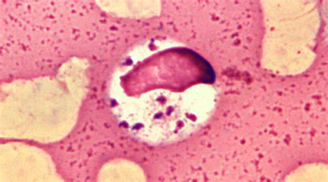 Leishmaniose Doenças Causadas Por Protozoários Parasitologia