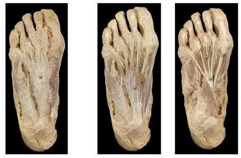 Foot Muscles Plantar Aspect Diagram Quizlet