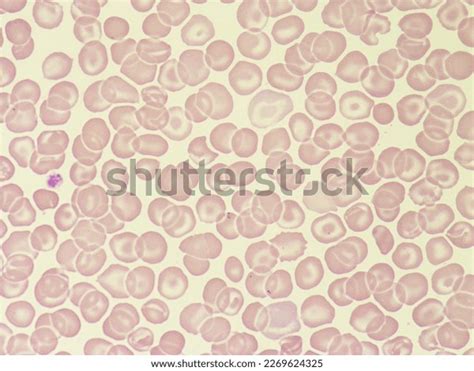 Red Blood Cells Blood Smear Platelets Stock Photo 2269624325 Shutterstock