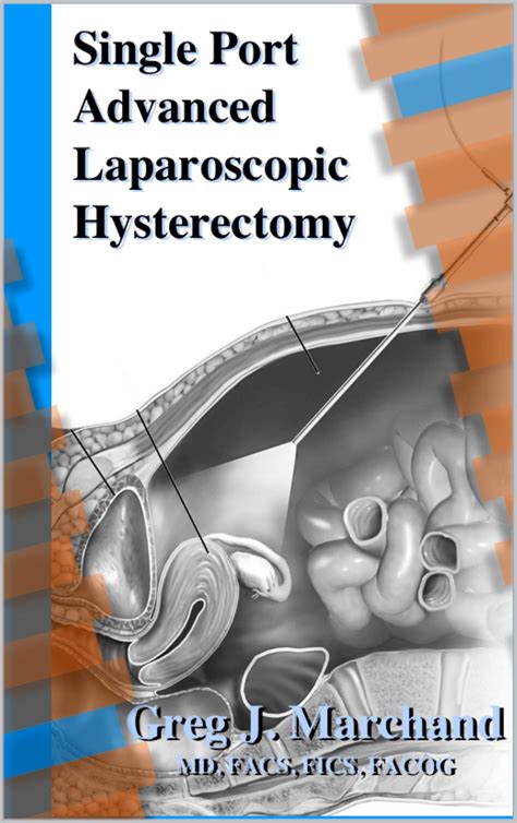 Buy Single Port Advanced Laparoscopic Hysterectomy An Advanced Ultra