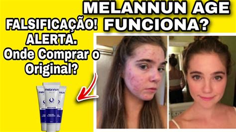 Melannun Age Onde Comprar Melannun Age Pre O Melannun Age Valor