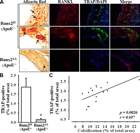 Figure From Smooth Muscle Cellspecific Runx Deficiency Inhibits