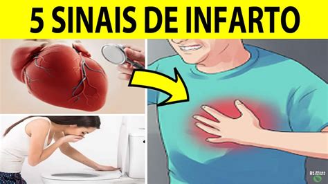 Sinais De Infarto Que Voc N O Pode Ignorar Youtube