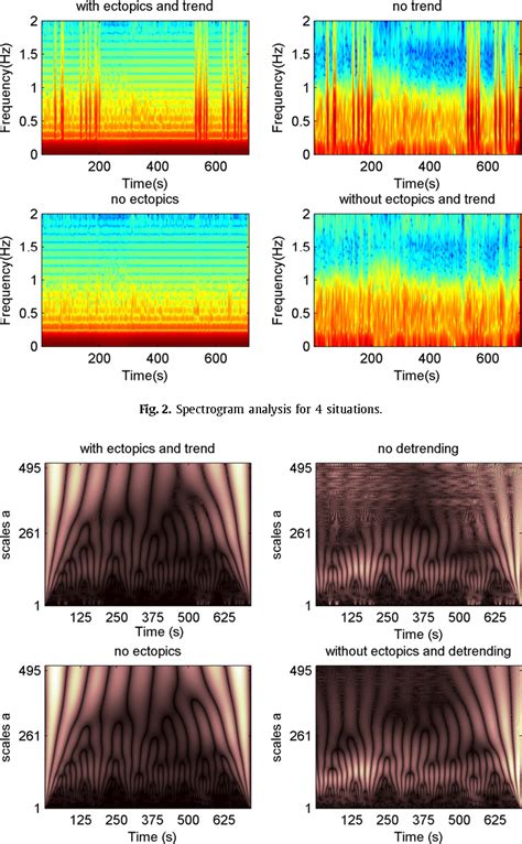 Figure 1 From Preprocessing Effects In Time Frequency Distributions And