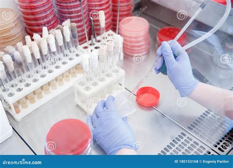 Microbiology Laboratory Agar Plate Full Of Micro Bacterias And