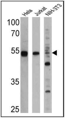 Ppar Alpha Nr C Antibody B Ppar Bsa Free Nb Novus