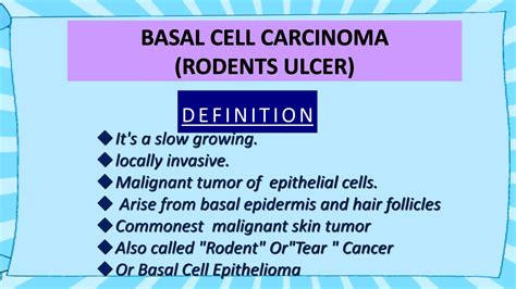 Rodent Ulcer Pptx