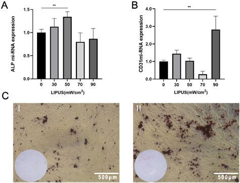 Lipus Promotes Osteogenic Differentiation Of Pdlscs A The Alp Mirna