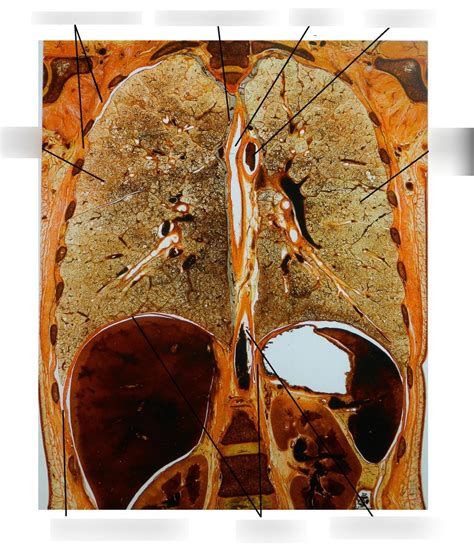 Frontal Section Thorax Diagram Quizlet