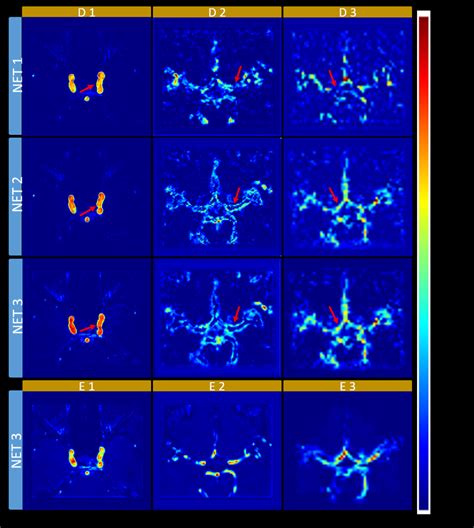 Examples of attention feature map. three encoders (E1, E2, and E3) and ...