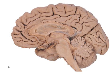 Midsagittal View Of Surface Ventricular Deep Structures Diagram Quizlet