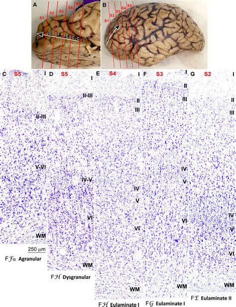 Cerebral Cortex Histology Layers