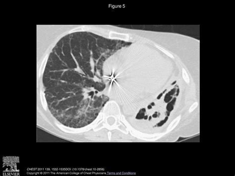 Volume 139 Issue 6 Pages June 2011 Ppt Download