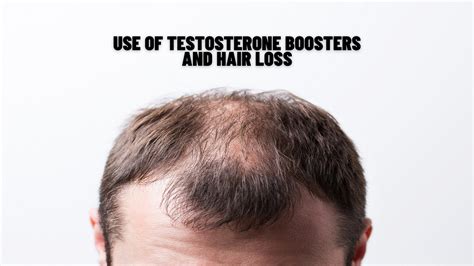 Does Use Of Testosterone Boosters Result In Hair Loss Know Science Facts