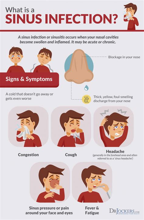 Is Sinus Infection Life Threatening