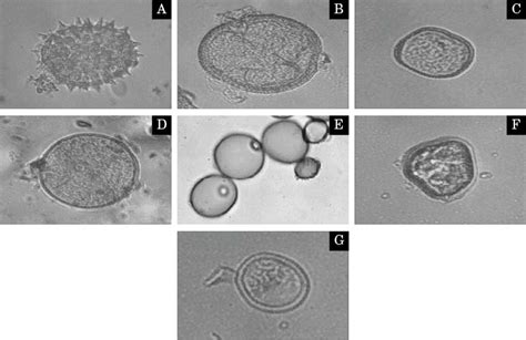 Light Microscopy Micographs Of Pollen Grains A Eclipta Alba B Download Scientific Diagram