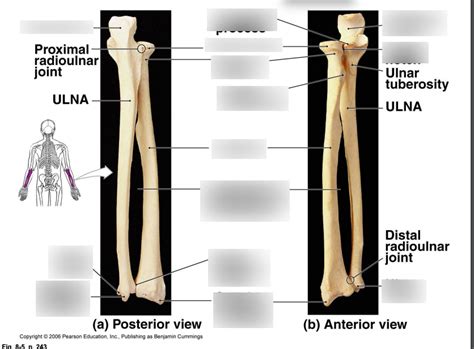 ULNA/RADIUS POSTERIOR/ANTERIOR VIEW Diagram | Quizlet