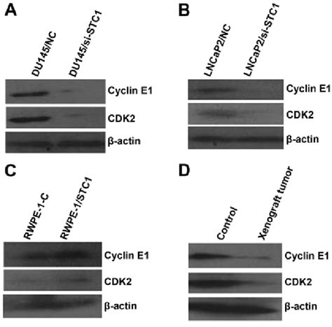 Expression Levels Of Cyclin E1 CDK2 Were Verified By Western Blotting