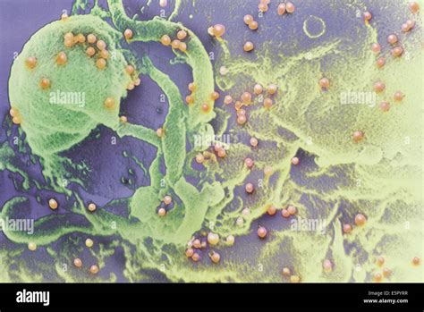 Colored Scanning Electron Micrograph Of HIV Viruses Red Dots Budding