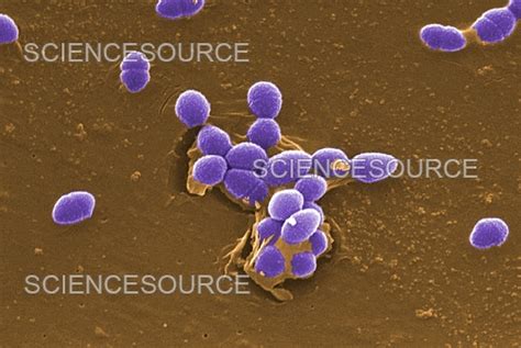 Photograph Enterococcus Faecalis Bacteria Sem Science Source Images