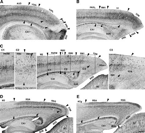 Low Power Photomicrographs Of Serial Parasagittal Neurofilament