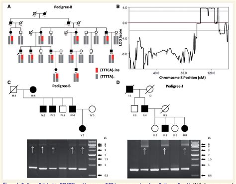 Figure From Intronic Pentanucleotide Tttca Repeat Insertion In The