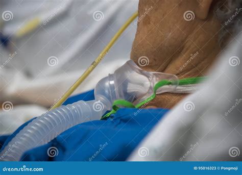 Patient Do Tracheostomy And Ventilator In Hospital Stock Image Image