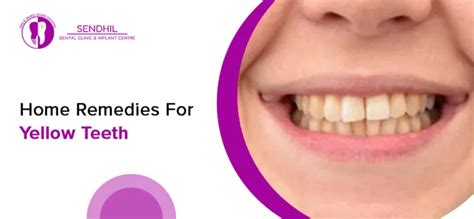home remedies  yellow teeth