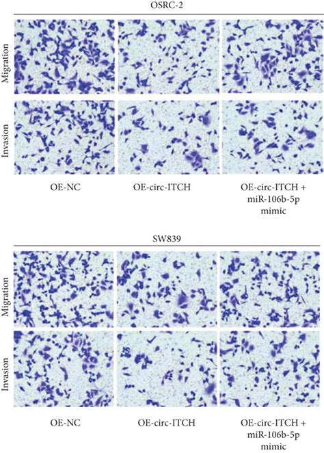 Circ Itch Inhibits Ccrcc Cell Metastasis Via Sponging Mir B P A