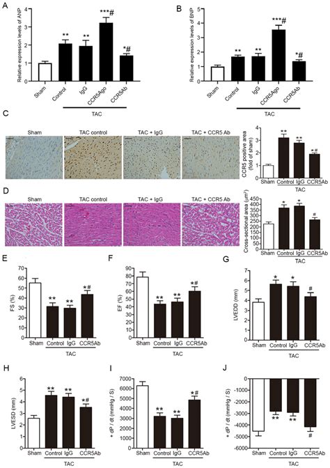 CCR5 Inhibition Ameliorates Pressure Overload Induced Myocardial