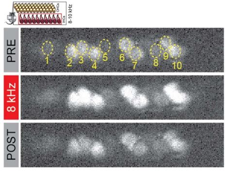 Hair Cell Function In Vivo Stanford Initiative To Cure Hearing Loss