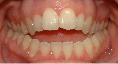 What Is Orthodontics Uttam Dental Clinic