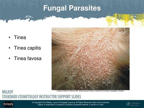 Human Parasites That Look Like Hair