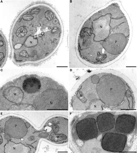 Peroxisome Electron Micrograph