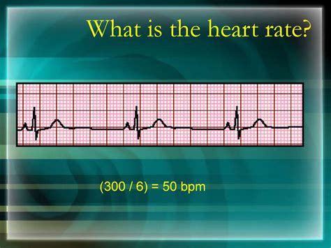 - Basics Of Ecg For Nurses Ppt