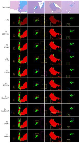 Coatings Free Full Text Deep Learning Based Layer Identification Of 2d Nanomaterials