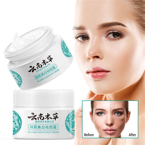 Whitening Freckle Cream Remove Dark Spots Anti Freckle Face Creams