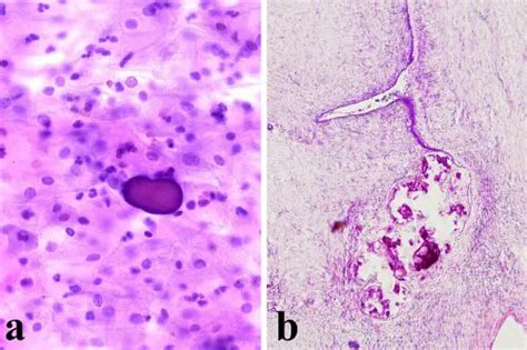 Cell Staining in Microscopy - Types, Techniques, Preparations and ...