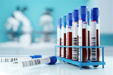 Where Is Whole Blood For Testing In A Clinical Laboratory Collected