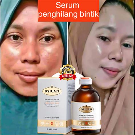 Jual Serum Flek Hitam Serum Flek Serum Penghilang Flek Hitam Ml