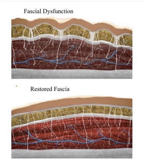 The Fascia System - Ohana Yoga Studio