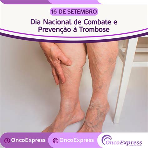 Dia Nacional De Combate E Preven O Trombose Oncoexpress