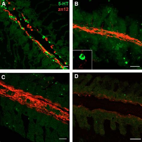 Double Immunolabelling Of Serotonin 5 Ht Green And Nerves Using A